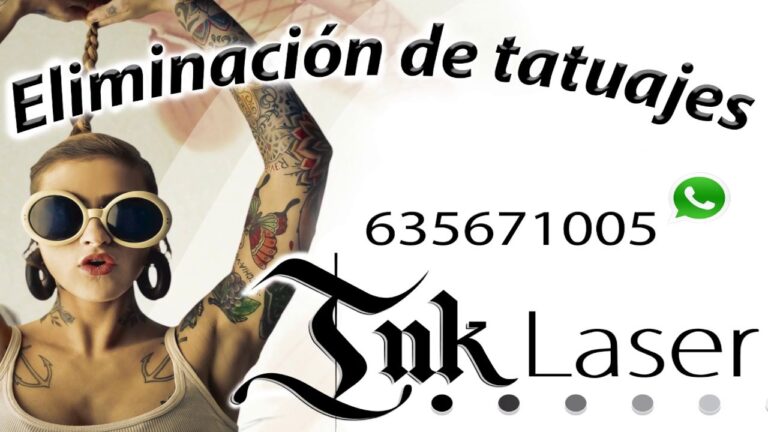 Descubre los precios más accesibles para eliminar tatuajes en Valencia